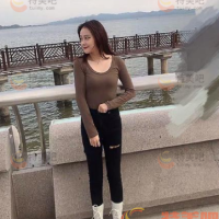 北京嘉禾医疗美容医院吸脂瘦大腿术,腿变细了