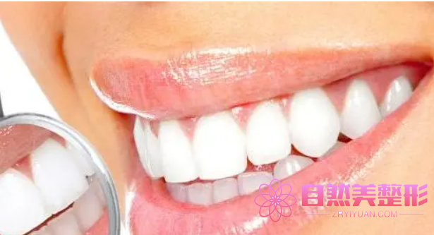 南京哪家医院最专业修复外伤性牙冠缺损整形？