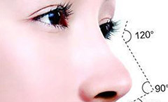 如何利用鼻小柱倾斜优势打造完美的面部轮廓
